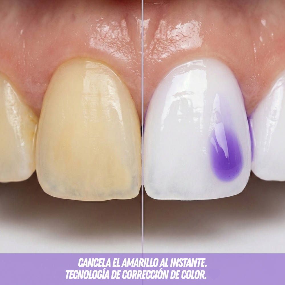 🦷 Obsessive Sonrisa™ - Corrector de color para una sonrisa perfecta sin dolor