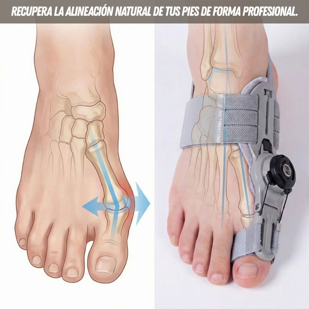 🦶 JuaneteFix Pro™ - Alineación profesional ajustable para tus pies sin cirugías